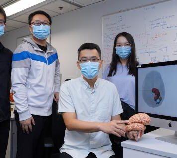 香港科技大学研究团队解开胶质瘤病人的化学抗性机制