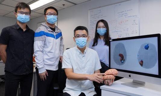 香港科技大学研究团队解开胶质瘤病人的化学抗性机制