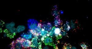 BROAD基金会推动南加大及其他高校的多名干细胞科学家、工程师和医生精英齐心协作