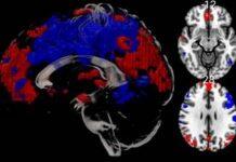 英国伯恩茅斯大学完成首例核磁共振_MRI脑部科研扫描