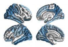 美国南加州大学研究所启动全球帕金森病研究