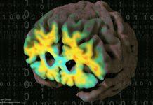 USC Stevens INI获巨资用于协调阿尔茨海默病的研究数据