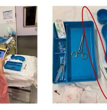 港科大研发人工智能导线辨识技术保障病人安全