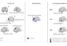 澳门大学在行为成瘾与神经决策研究取得重要进展