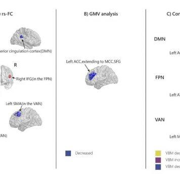 澳门大学在行为成瘾与神经决策研究取得重要进展