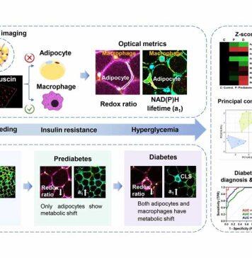 澳门大学开发创新检测技术筛查早期糖尿病