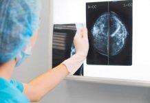 研究揭示人工智能帮助检测乳腺癌