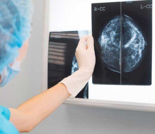 研究揭示人工智能帮助检测乳腺癌