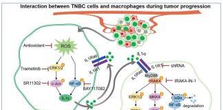 澳门大学研究团队发现抵抗乳腺癌转移新机制