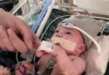 世界首例部分心脏移植术后一年证实成功